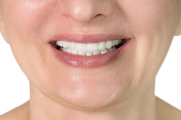 Obraz premium close up of beauty woman tooth, isolated on white background