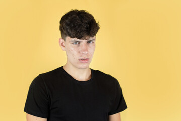 A teenage boy on a yellow background with pimples on his face is suffering from a headache, a...