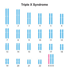 Scientific Designing of Triple X Syndrome (Trisomy X) Karyotype. Colorful Symbols. Vector Illustration.