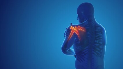 Pain in the shoulder joint