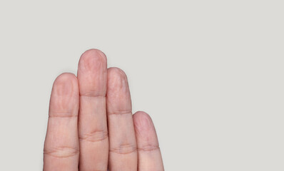 woman palms hands fingers isolated on light background.wrinkled pruney fingers from staying too long in water.young female palm wrinkles on fingers.body parts details.wide open hand fingers