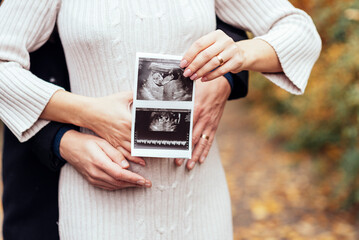 Happy couple with pregnancy news holding ultrasound baby scan. Pregnant woman and her husband expecting child. Pregnancy, maternity concept. Parents hands on pregnant belly holding x-ray. closeup