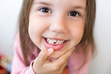 Close up of smiling girl showing her missing teeth. Kid lost first milk tooth and preparing for...