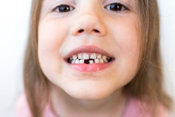 Close up of smiling girl showing her missing teeth. Kid lost first milk tooth and preparing for visit from tooth fairy. Selective focus