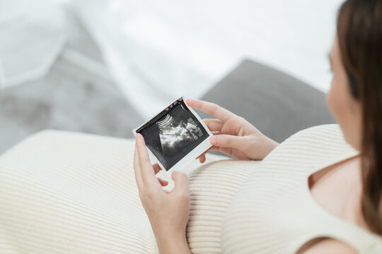 Selective focus, Ultrasound image of her baby on hand pregnant woman is sitting on the couch in the living room.