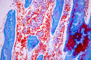 Hyaline cartilage, Elastic cartilage and Bone Human under the microscope in Lab.