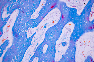 Hyaline cartilage, Elastic cartilage and Bone Human under the microscope in Lab.