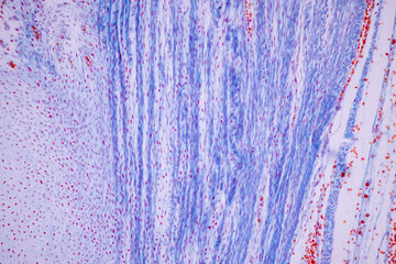 Hyaline cartilage, Elastic cartilage and Bone Human under the microscope in Lab.