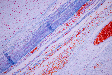 Hyaline cartilage, Elastic cartilage and Bone Human under the microscope in Lab.