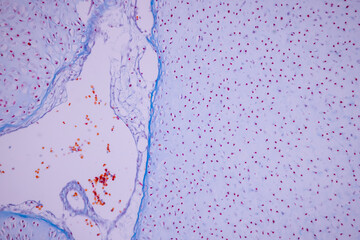 Hyaline cartilage, Elastic cartilage and Bone Human under the microscope in Lab.