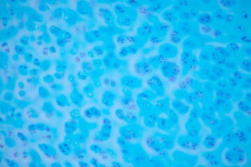 Hyaline cartilage, Elastic cartilage and Bone Human under the microscope in Lab.