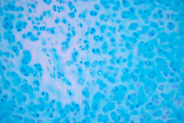 Hyaline cartilage, Elastic cartilage and Bone Human under the microscope in Lab.