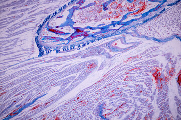 Hyaline cartilage, Elastic cartilage and Bone Human under the microscope in Lab.