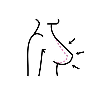 Plastic surgery. Illustration of Breast Surgical Operation.
