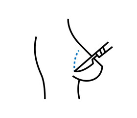 Plastic surgery. Illustration of Breast Surgical Operation.

