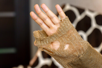 Mending clothes. Repairing woolen sweaters, shopping less concept. Selective focus - obrazy, fototapety, plakaty