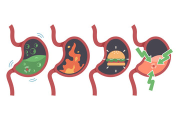 Gastric bloating vector cartoon set isolated on a white background.