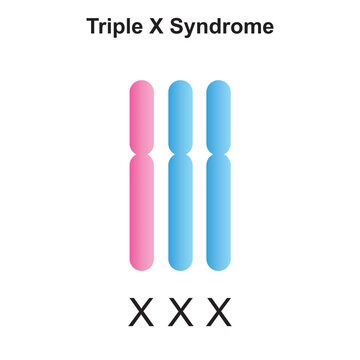 Scientific Designing Of Triple X Syndrome (Trisomy X). Colorful Symbols. Vector Illustration.