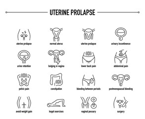 Uterine Prolapse vector icon set. Line editable medical icons.