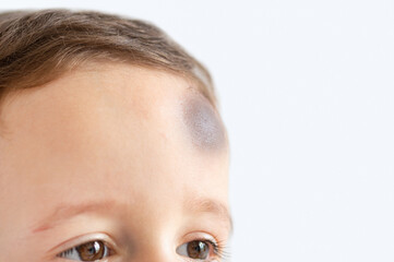 Close-up of a boy with injury on head with copy space