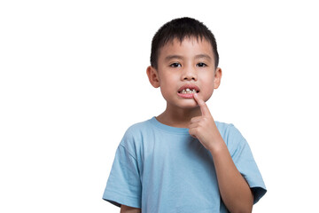 Child lost teeth Toothless child Pointing finger at mouth showing teeth gap