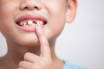Close up headshot cropped image little preschool cute boy widely smilin showing empty space