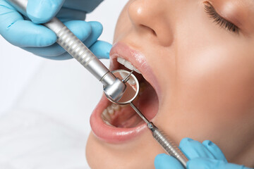 A dentist doctor treats caries on a tooth of a young beautiful woman in a dental clinic. Tooth...