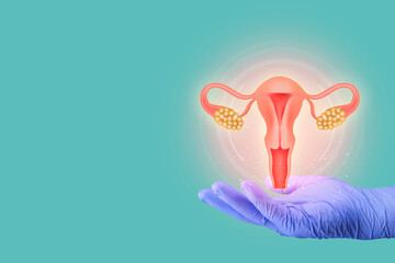 Female reproductive health concept. endometriosis, PCOS, gynecological cancer, cervical cancer,...
