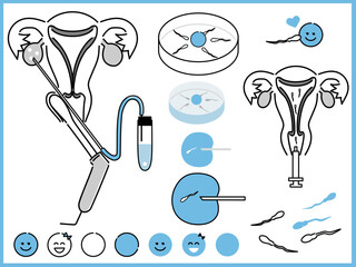 不妊治療、顕微授精、体外受精、人工授精のイラスト