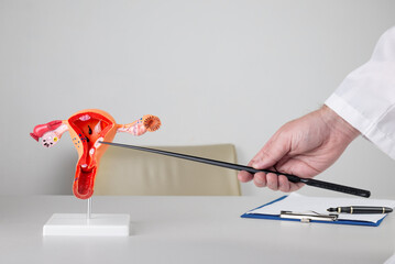 doctor gynecologist pointing model of female reproductive system on his desktop