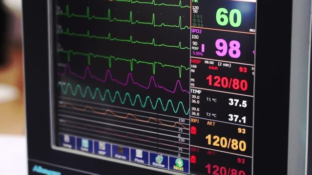 Patient monitor displays vital signs ECG electrocardiogram EKG, body temperature, oxygen saturation SPO2 and respiration.