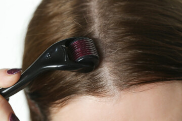 Woman using microneedle derma roller on head for stimulating new hair growth. Simple and cheap...