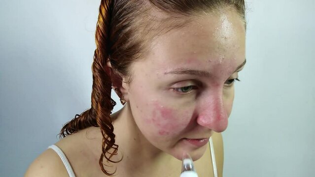 Young woman using blackhead remover device