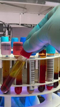 Centrifuge machine has just centrifuged tubes with blood samples for analysis in the laboratory. doctor holding a tube with a centrifuged blood sample for separation of plasma and blood serum for test