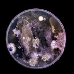 Samples of Petri dishes with a culture of microorganisms and fungi in the surface of agar nutrient...