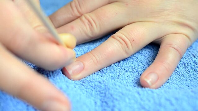 Female manicure. We delete agnails