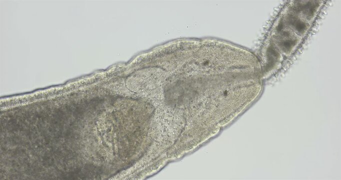 Nemertea worm under a microscope, class Hoplonemertea, order Monostilifera. TYou can see the proboscis. Specimen was found in the White Sea.