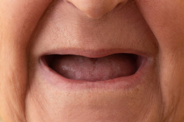 old woman's mouth without teeth
