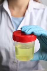 Doctor holding container with urine sample for analysis, closeup