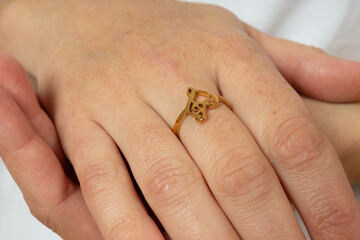 a ring with a treble clef on palms closed with each other