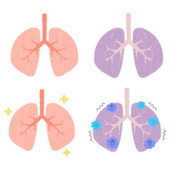 健康な肺と不健康な肺のセットイラスト