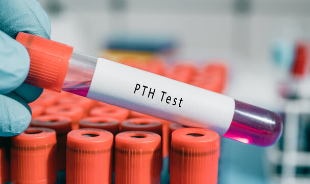 Parathyroid glands Parathyroid hormone  PTH Test Most important regulator of blood calcium levels