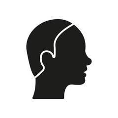Bald Male Silhouette Icon. Hairless Man Black Pictogram. Alopecia Medical Problem Icon. Isolated Vector Illustration