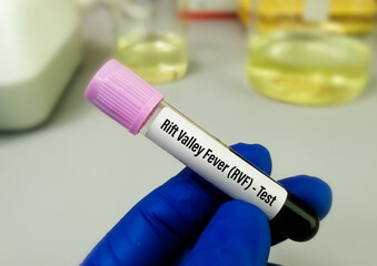 Rift valley fever virus test, an RNA virus of Bunyaviridae family, transmitted from infected...