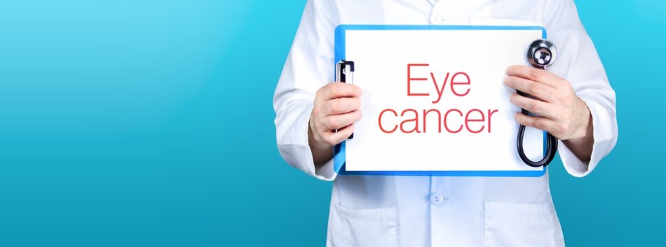 Eye Cancer. Doctor Holding Blue Sign With Paper. Word Is Written On Document. Stethoscope In Hand.