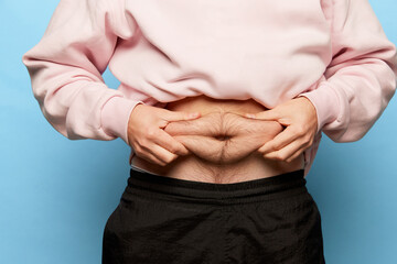 Closeup male hands using pinch test as method for measuring body fat on belly. Concept of dieting, sport, fitness, healthy lifestyle, body positive and wellbeing