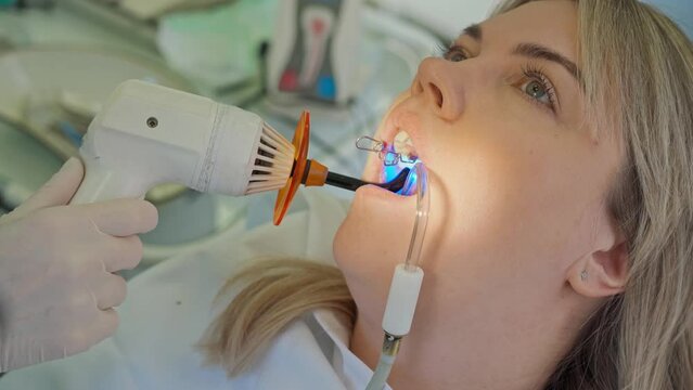 close-up of a female mouth and hands of a dentist with a lamp for pasteurization of fillings in the mouth.stomatology. dental treatment. doctor treating a young woman's tooth