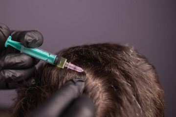 Mesotherapy for hair. Attractive man receiving injections in his head. Man having mesotherapy...