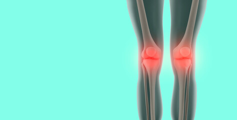 Joint pain, arthritis and tendon problems. human knees with inflammation and pain. X-ray concept. knee problems. modern medicine, emerald green background
