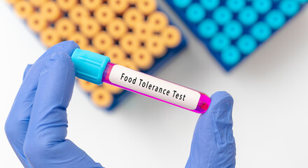 Food intolerance test result with blood sample in test tube on doctor hand in medical lab